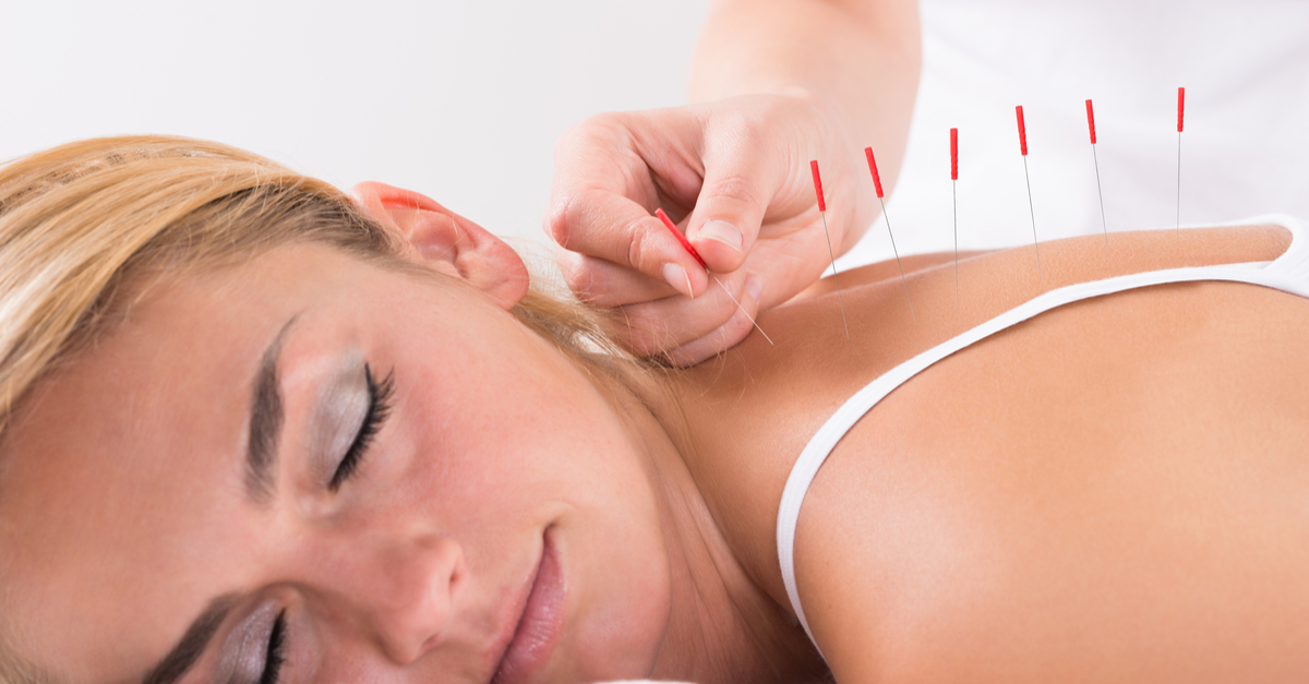 Acupuncture Clinic of New Zealand